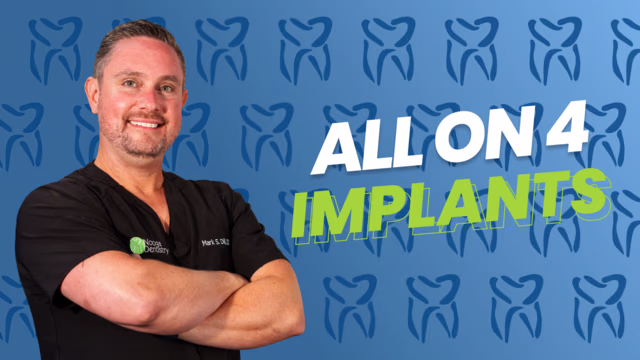 Dr. Mark Dill explains All-on-4 implants in Chattanooga, TN