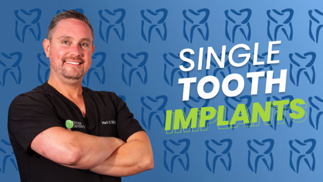 Dr. Mark S. Dill explains single tooth implants in Chattanooga, TN