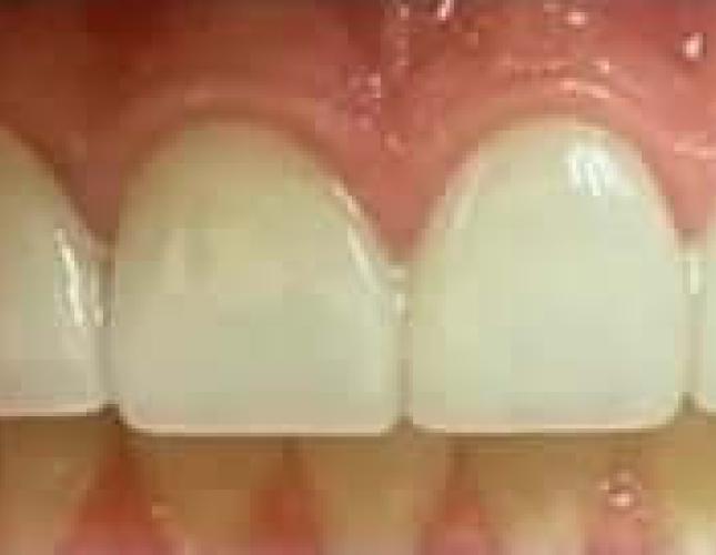 Cosmetic after