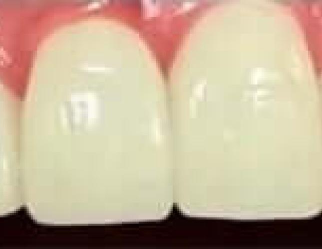 Restorative after