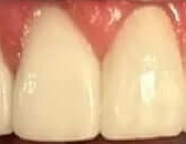 Restorative after