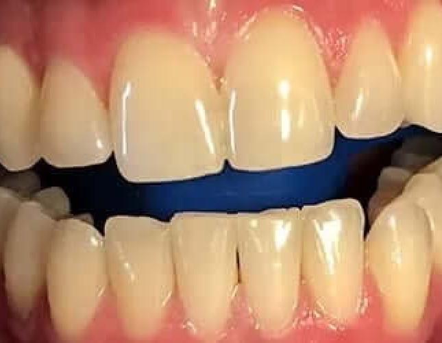 Whitening before